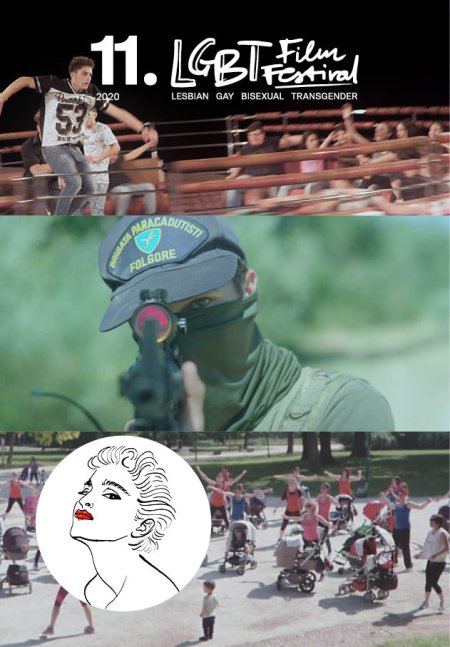 Normal